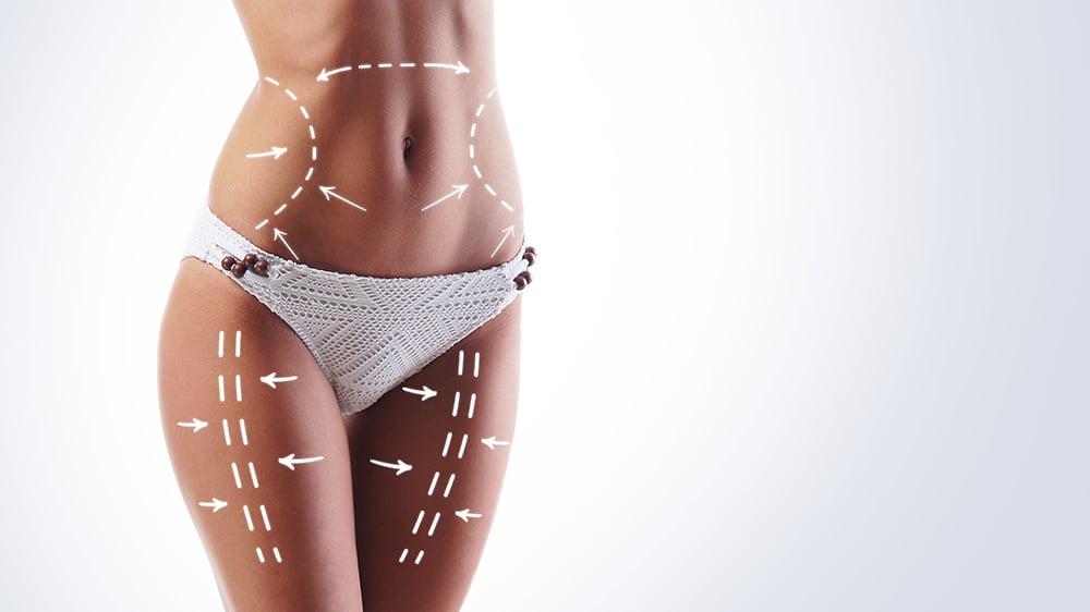 cryo slim3